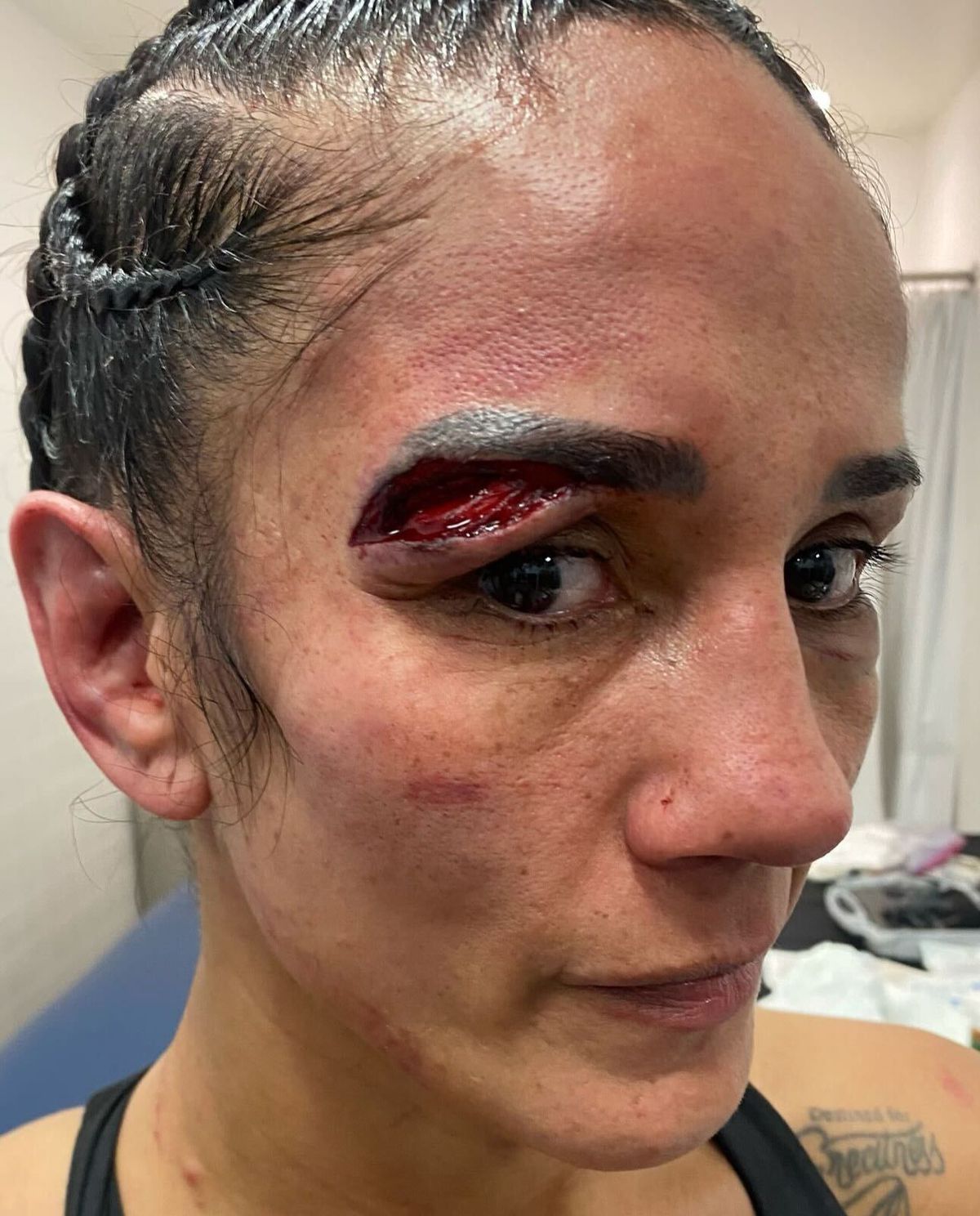 Amanda Serrano mostra corte horrível sofrido por inúmeras cabeçadas na revanche de Katie Taylor